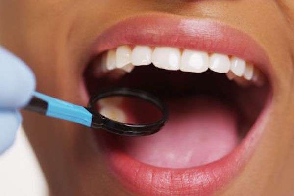 How a General Dentist Treats Cavities from Bluebonnet Dental in Houston, TX